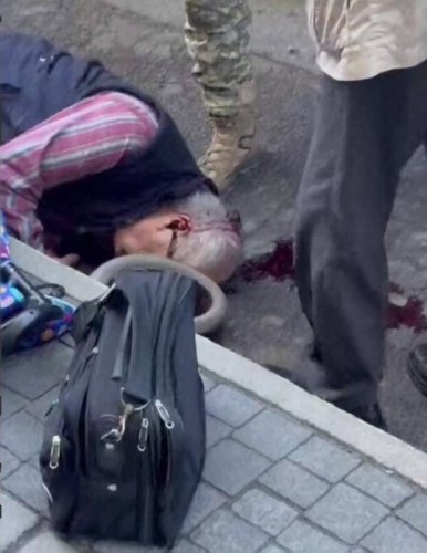 76-річний пасажир випав з автобуса у Львові та перебуває в комі – 01